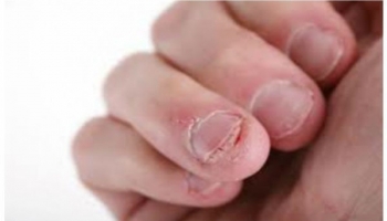 ¿Cansado de ver que tu hijo se muerde las uñas?